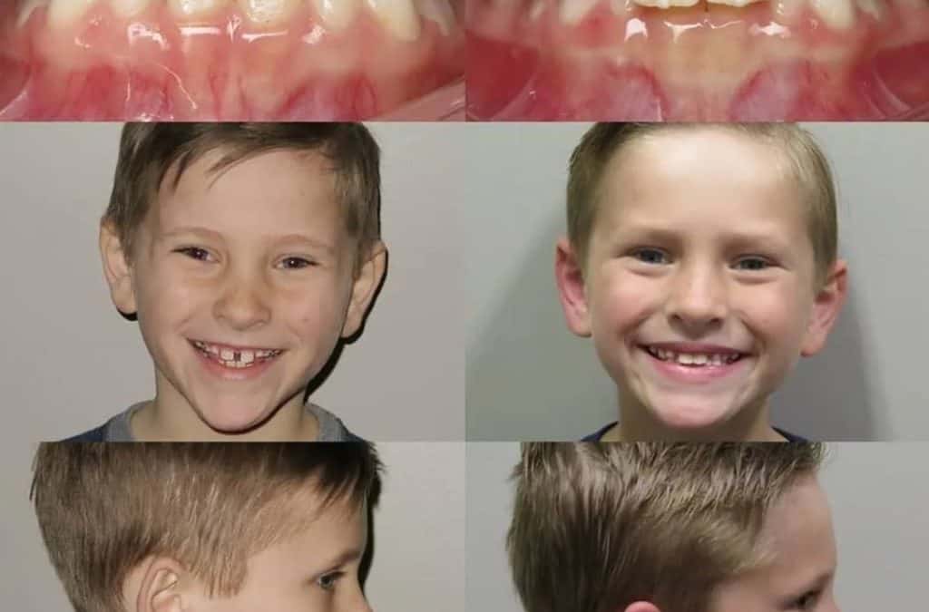 Early Ortho Success