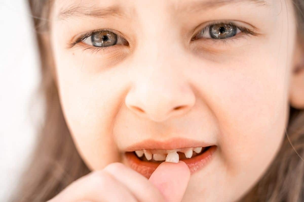 Child with a knocked-out baby tooth